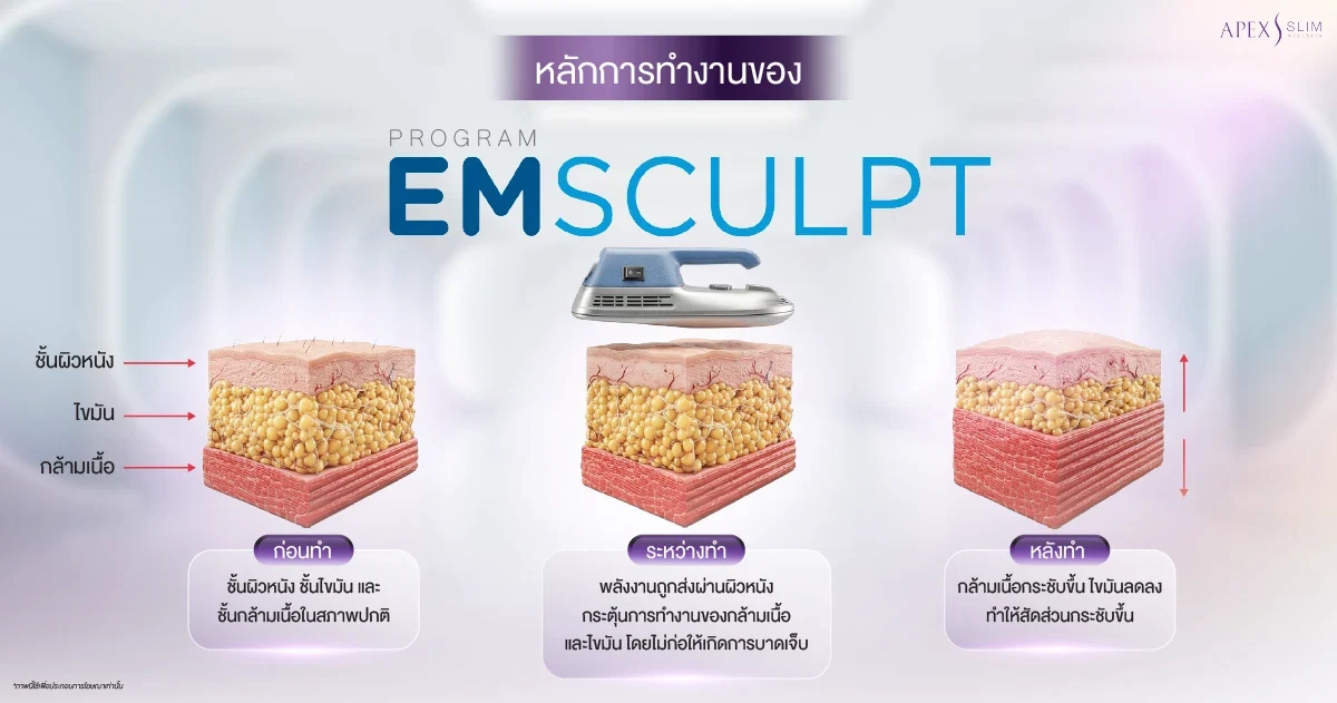 หลักการทำงานของ Emsculpt